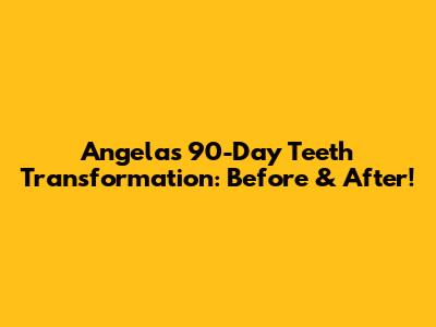 Angela's 90-Day Teeth Transformation: Before & After!